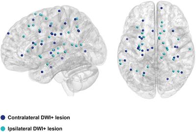 Diffusion-Weighted Lesions After Intracerebral Hemorrhage: Associated MRI Findings